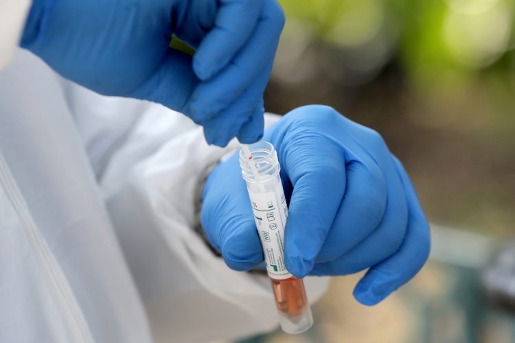 States falling short on virus testing